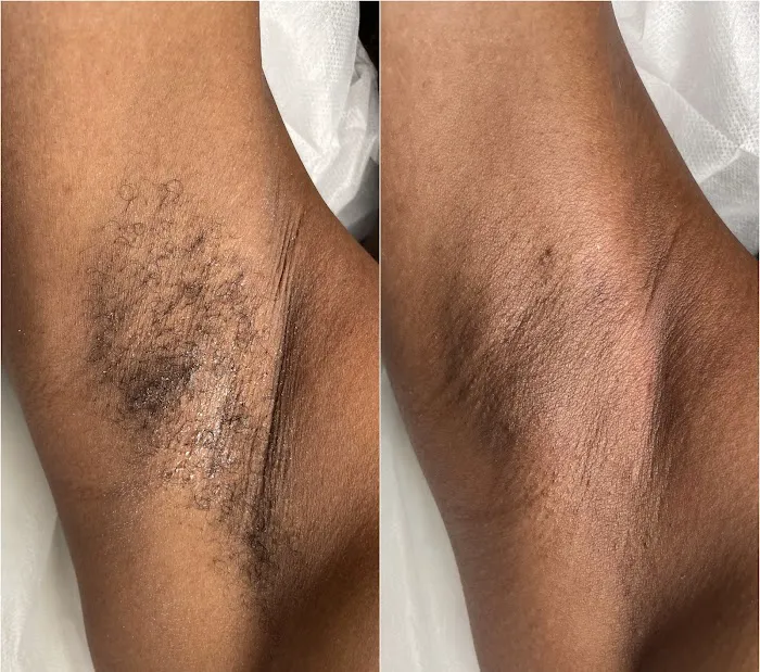 Skin by Li - West Hartford Esthetician Picture 3