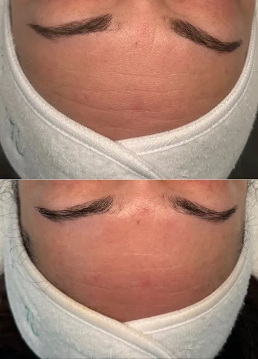 Skin by Li - West Hartford Esthetician Picture 5