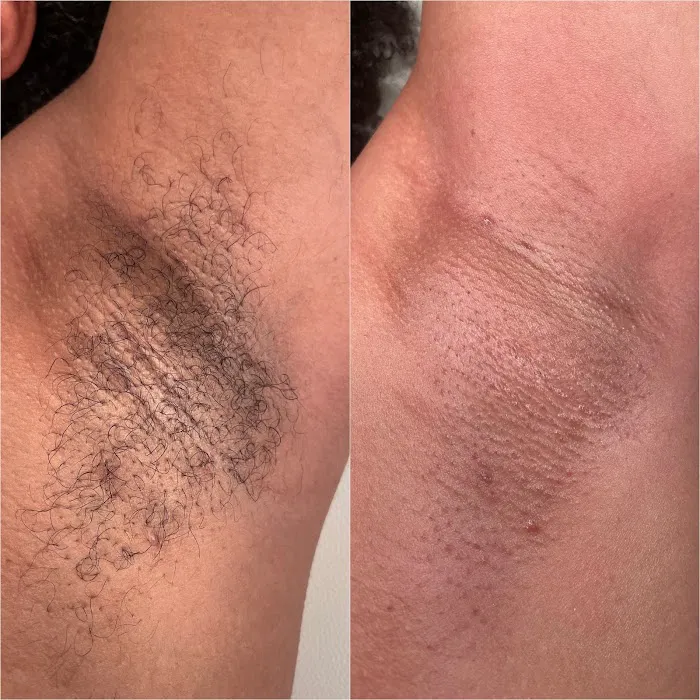 Skin by Li - West Hartford Esthetician Picture 8