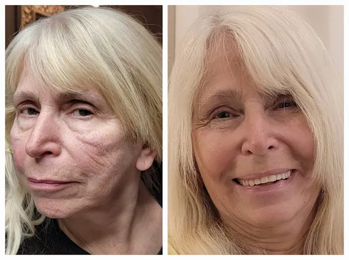 About Face Advanced Skin Care Picture 6