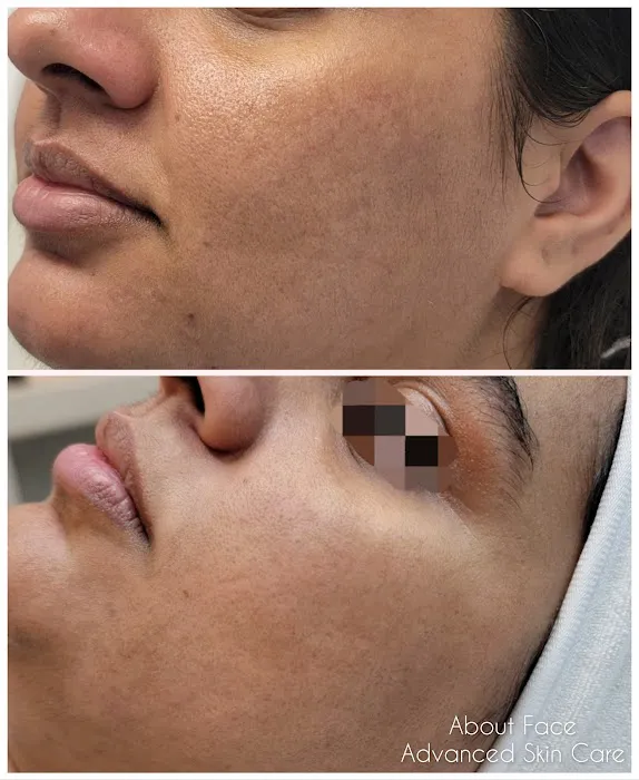 About Face Advanced Skin Care Picture 8