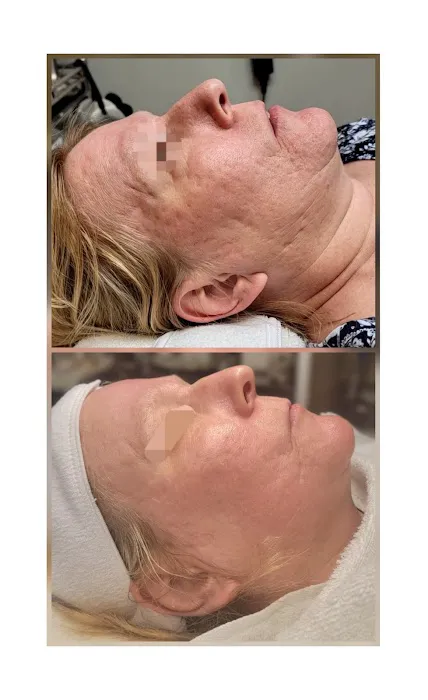 About Face Advanced Skin Care Picture 9