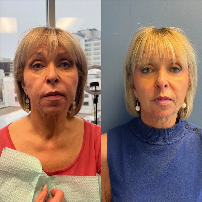 Refreshed Medical Aesthetics Picture 4