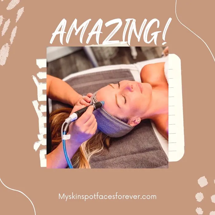 My Skin Spot Picture 6