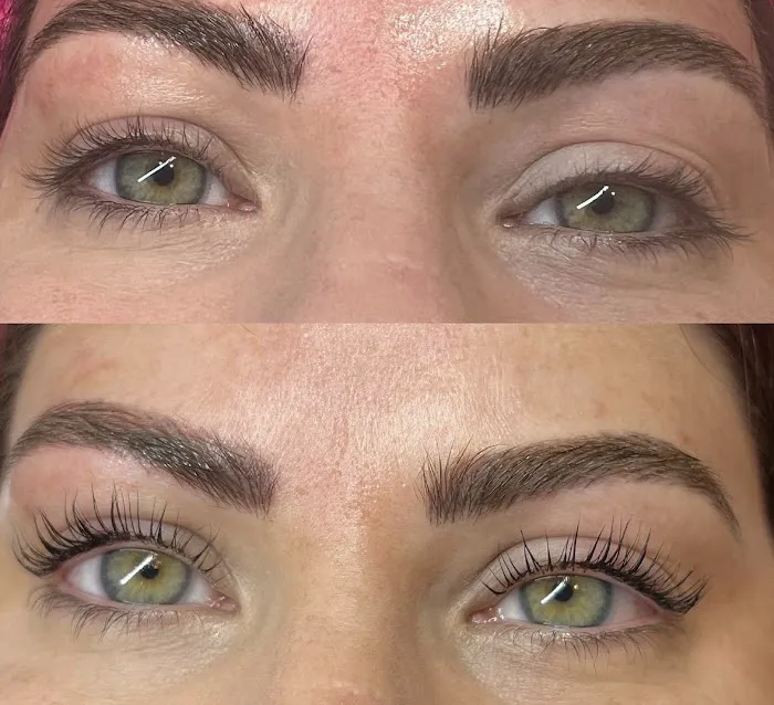 My Skin Spot Picture 10