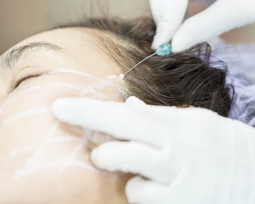 Ageaway Medical Spa Picture 1