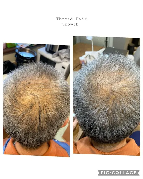 Ageaway Medical Spa Picture 10