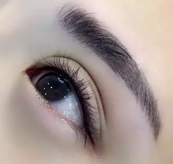 Young Skin Care Inc Picture 4