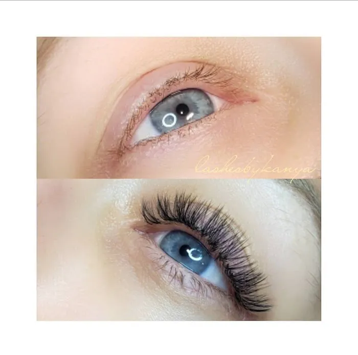 Kanyaesthetics Picture 3