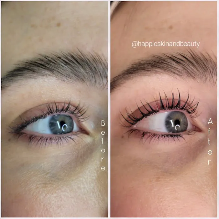 Kanyaesthetics Picture 1