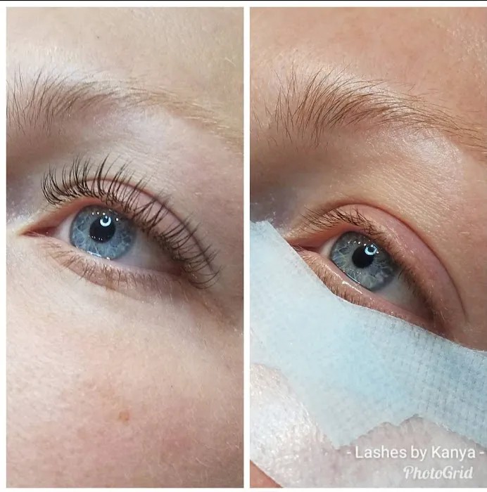 Kanyaesthetics Picture 5