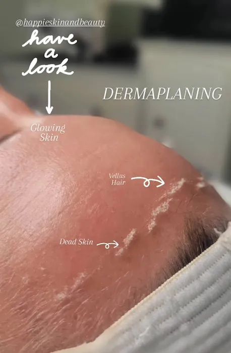 Kanyaesthetics Picture 6