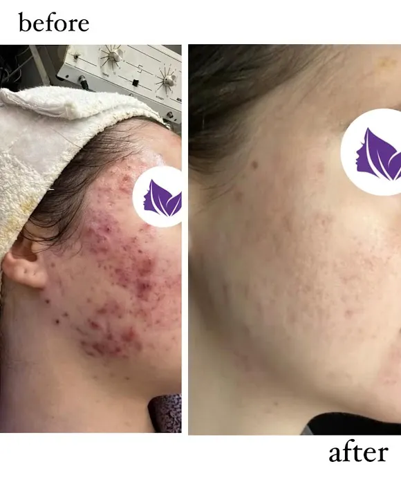 Pure Aesthetics NY Picture 5