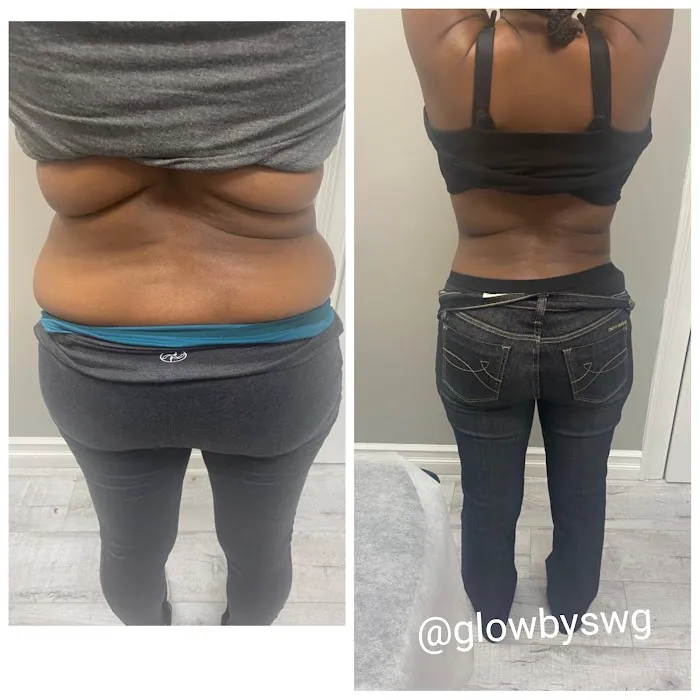 GLOW BY SWG Picture 2