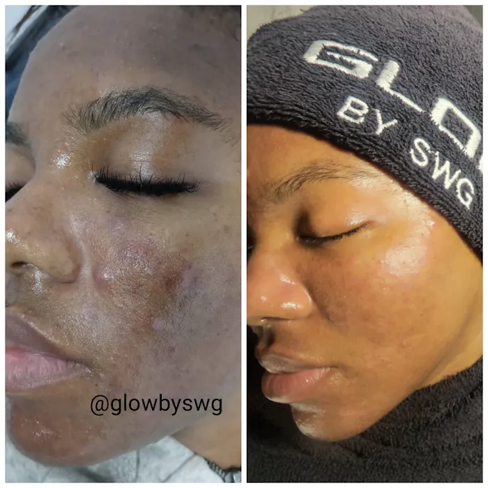 GLOW BY SWG Picture 9