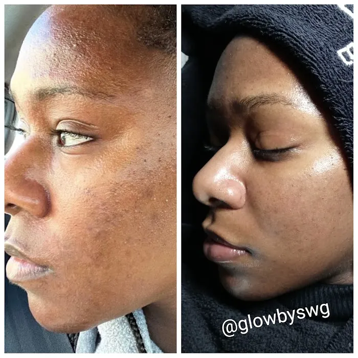 GLOW BY SWG Picture 8