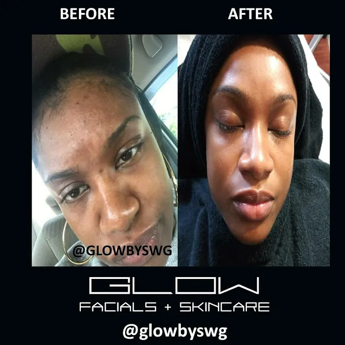 GLOW BY SWG Picture 7