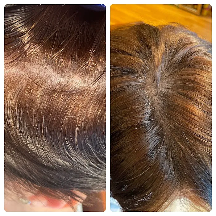 Natalya Urovish MD PC -- PRP, Fillers, Botox Picture 2