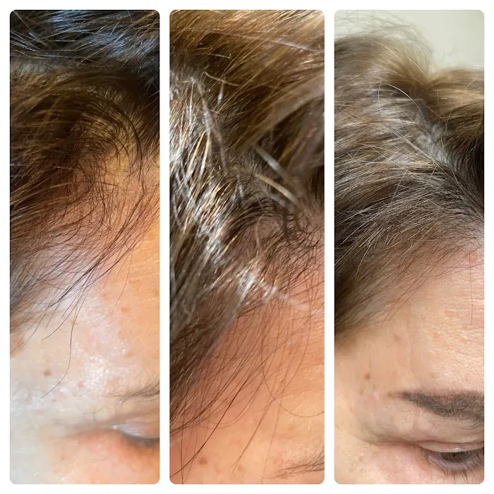 Natalya Urovish MD PC -- PRP, Fillers, Botox Picture 3