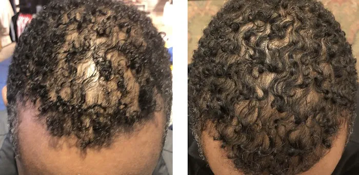 Natalya Urovish MD PC -- PRP, Fillers, Botox Picture 1