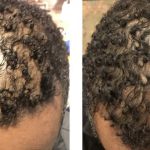 Natalya Urovish MD PC -- PRP, Fillers, Botox