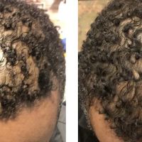 Natalya Urovish MD PC -- PRP, Fillers, Botox ico