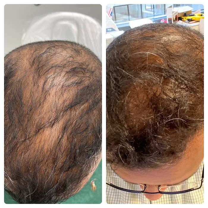 Natalya Urovish MD PC -- PRP, Fillers, Botox Picture 6