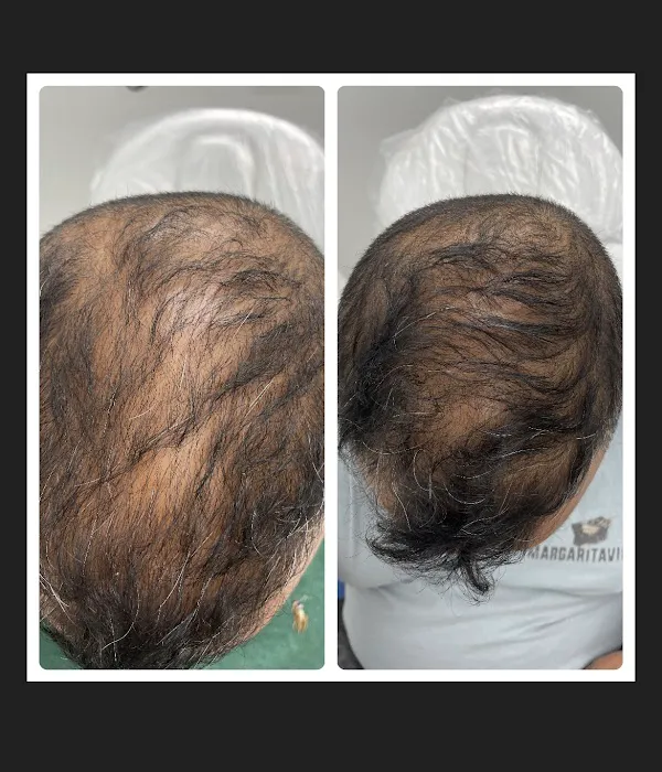 Natalya Urovish MD PC -- PRP, Fillers, Botox Picture 10