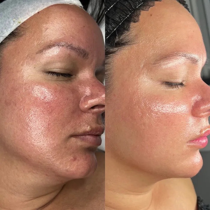 SBB Skin By Brianna Picture 6