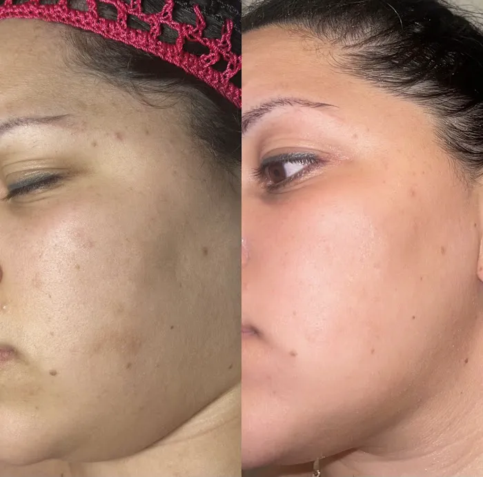 SBB Skin By Brianna Picture 9