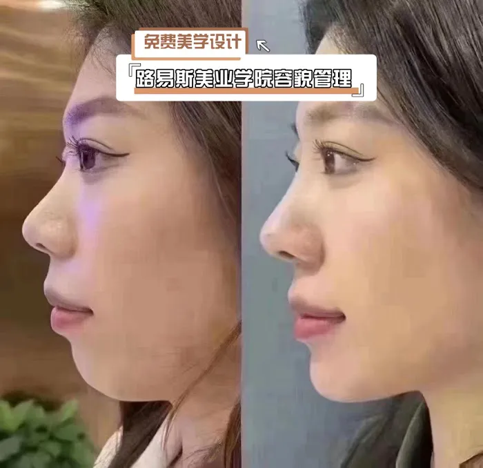 Louis Beauty Center Picture 4