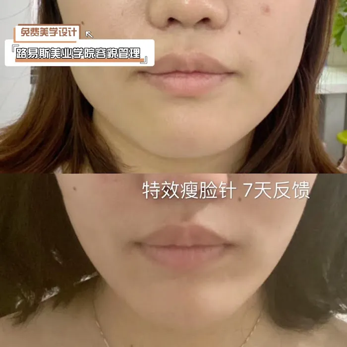 Louis Beauty Center Picture 9