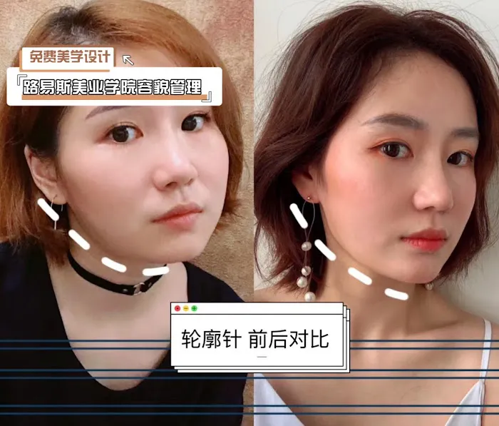 Louis Beauty Center Picture 10