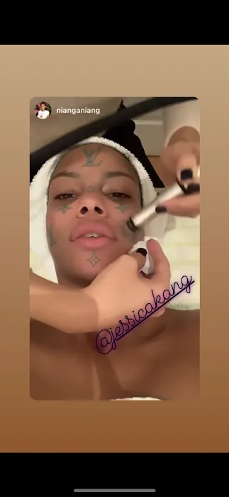 Skin Sarang Celebrity Facial Spa: Microneedling, Hydrafacial, Radio Frequency, Microcurrent Facial & Face Lift Treatments Picture 6