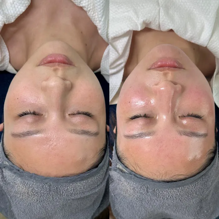 Beauon K | 파메스테틱 | 플러싱스킨케어 | 뉴욕스킨케어 | 플러싱 반영구, 두피관리 SMP Picture 10