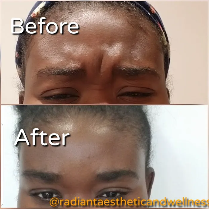 Radiant Aesthetic and Wellness Picture 10