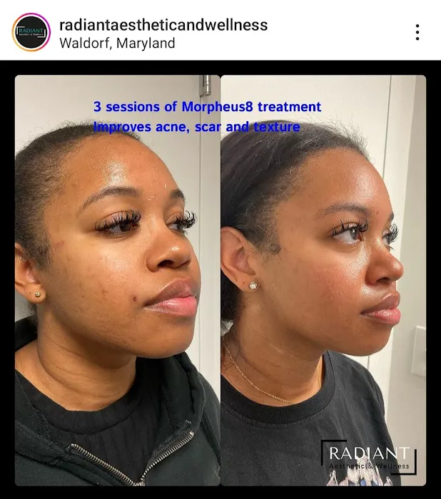 Radiant Aesthetic and Wellness Picture 9