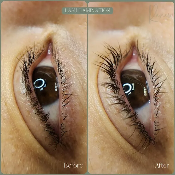 Renew Skin Studio Picture 4