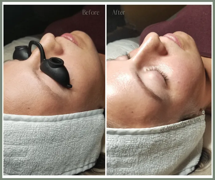 Renew Skin Studio Picture 6