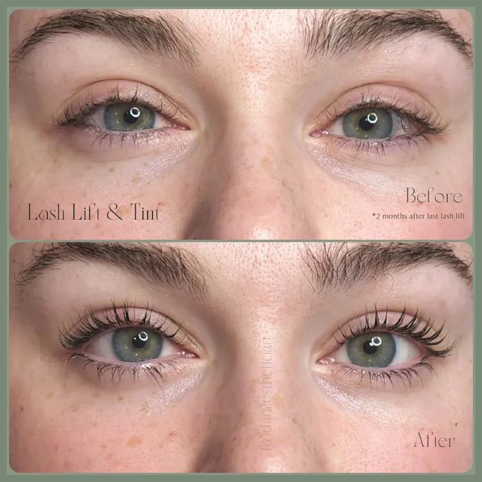 Renew Skin Studio Picture 5