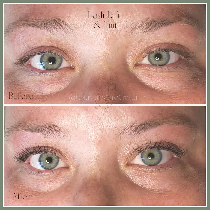 Renew Skin Studio Picture 8