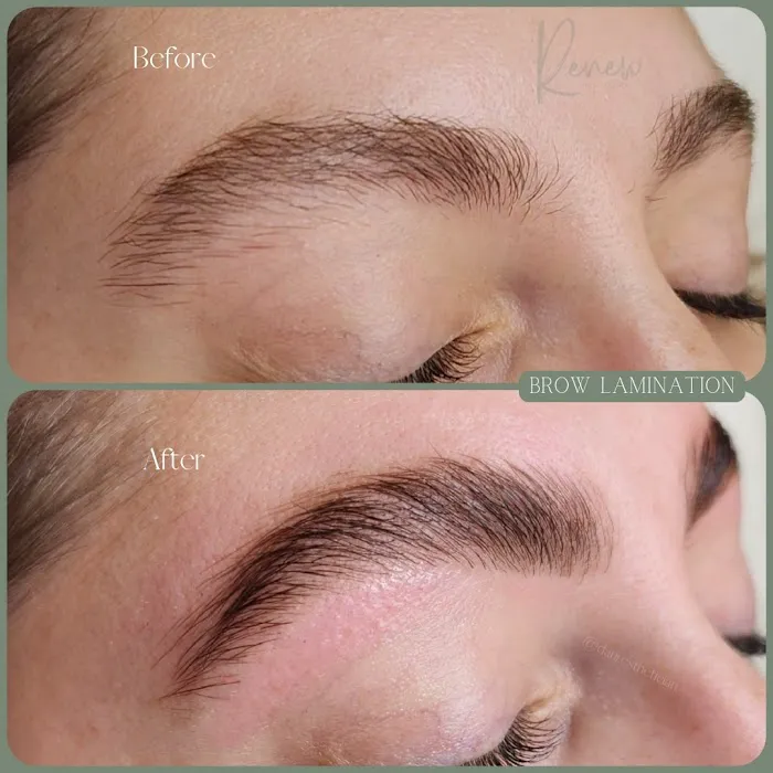 Renew Skin Studio Picture 9