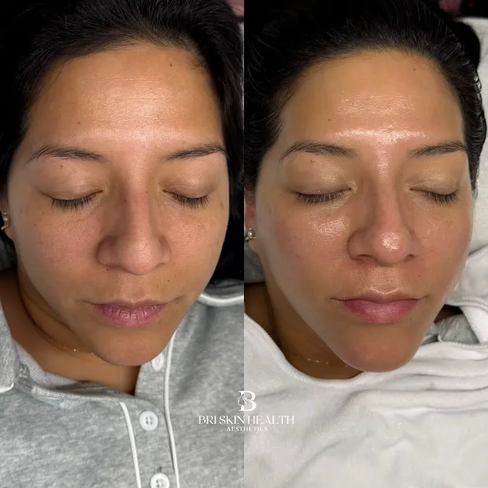 Bri Skin Health Aesthetics Picture 2