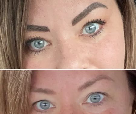 Dermasologyu00aeufe0f