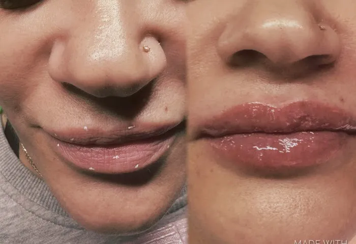 Bellisima by Nai Picture 2