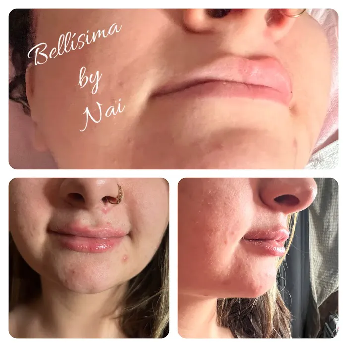 Bellisima by Nai Picture 7