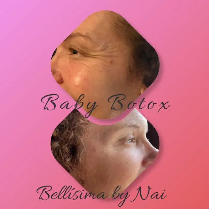 Bellisima by Nai Picture 9