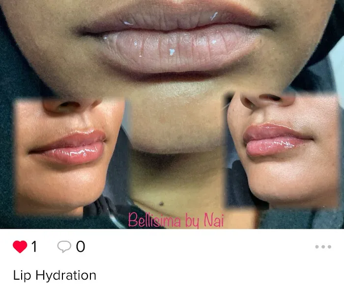 Bellisima by Nai Picture 8