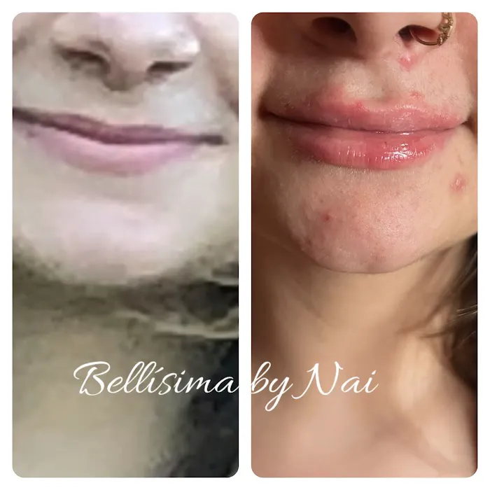 Bellisima by Nai Picture 10