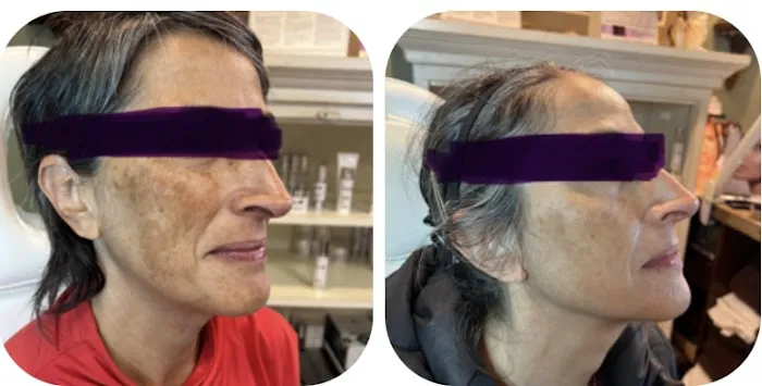 SoniaGenix® Picture 5